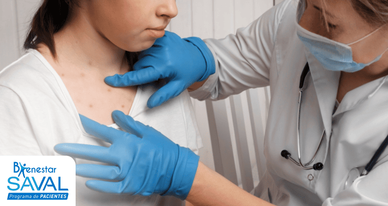 alergia por estres senales y tratamiento